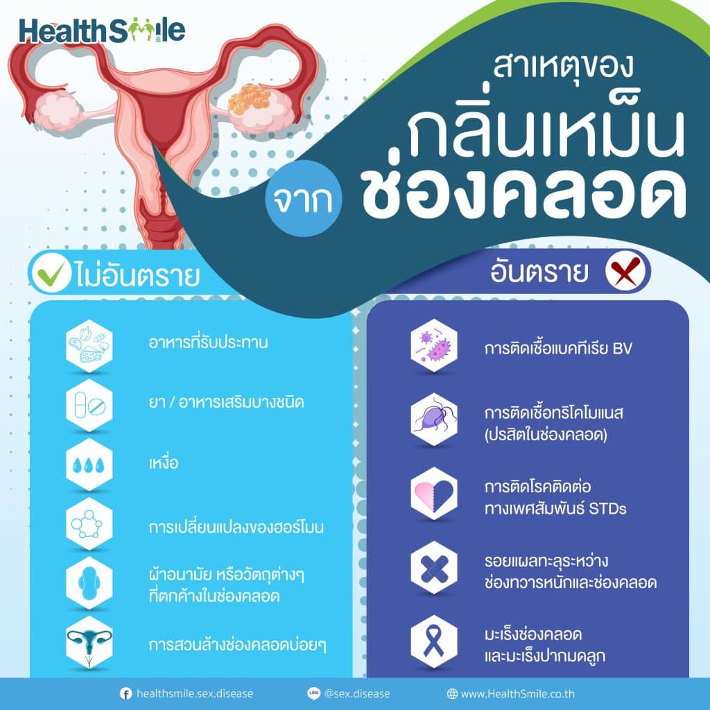 [QA] สาเหตุกลิ่นเหม็นช่องคลอด