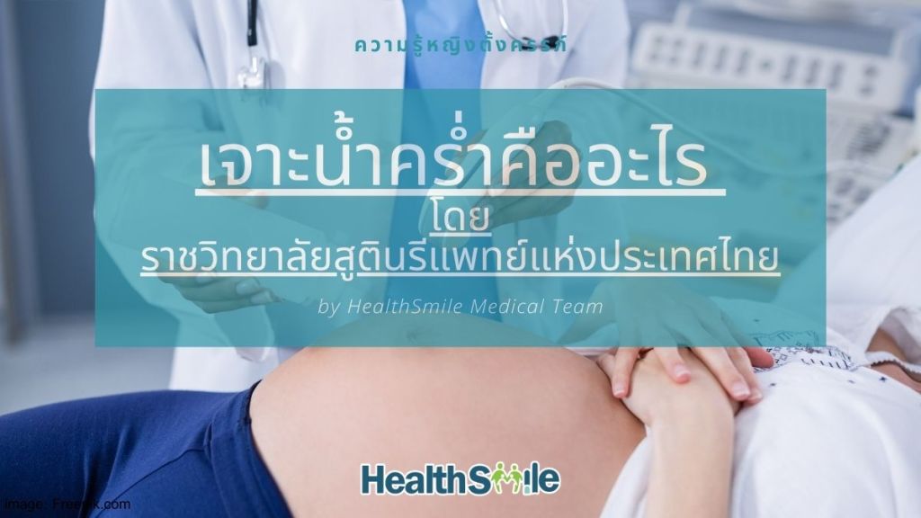 เจาะน้ำคร่ำคืออะไร โดยราชวิทยาลัยสูตินรีแพทย์แห่งประเทศไทย