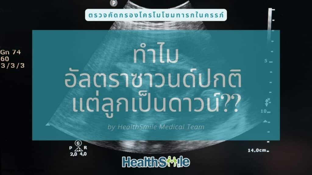 ทำไม อัลตราซาวด์ปกติ แต่ลูกเป็นดาวน์ซินโดรม??