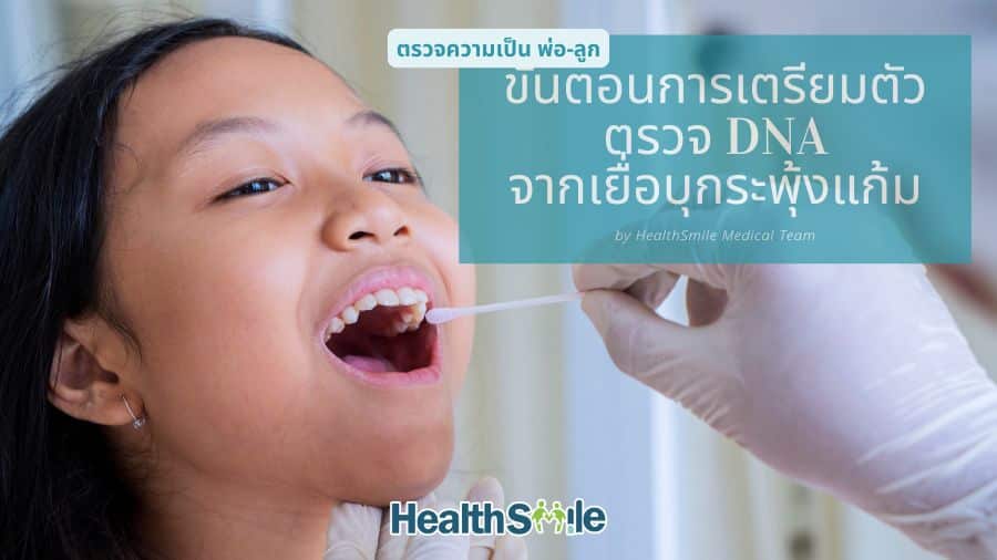 ขั้นตอนการเตรียมตัวก่อนการตรวจ DNA จากเยื่อบุกระพุ้งแก้ม